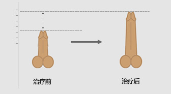昌吉男科医院