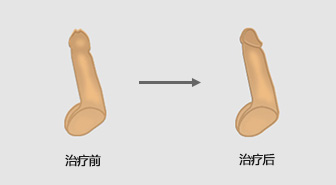 昌吉男科医院